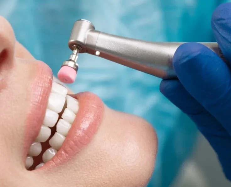 Book+a+Dental-Hygienist+in+London