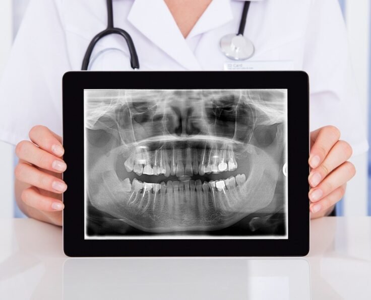 dental-xray-myths