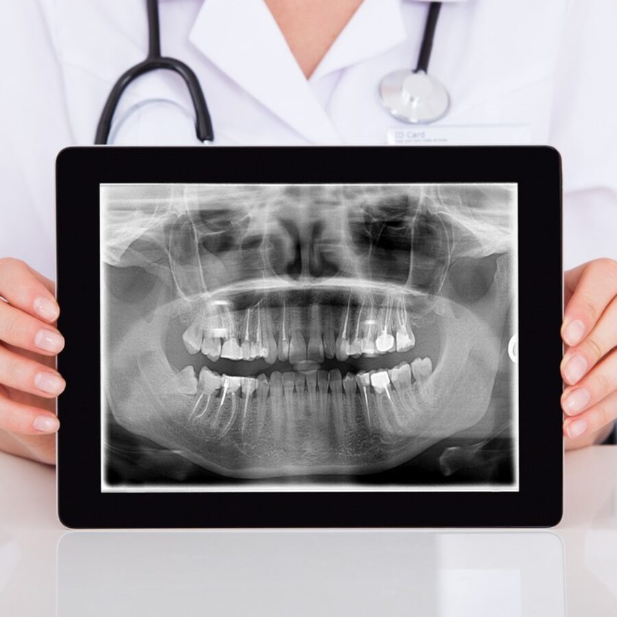 dental-xray-myths